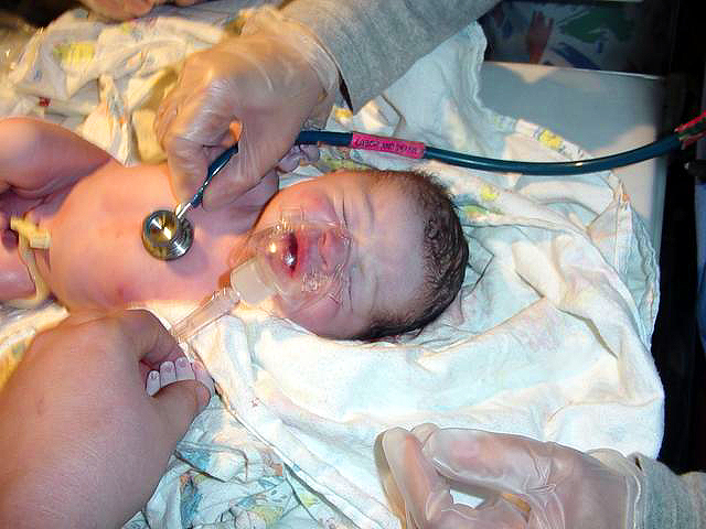 Image of babyo2.jpg