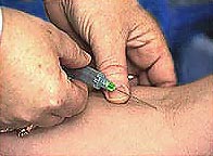 Image of ivstick.jpg