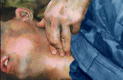 Image of carotidpulsemanclose.jpg