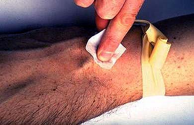Image of ivwiping.jpg