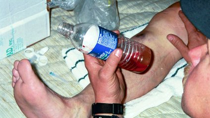 Image of kneefracturebloodsamplewaterbottle.jpg