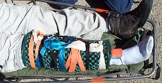 Image of stokessplint.jpg
