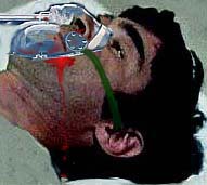 Image of caphurtcloseo2maskbloody.jpg