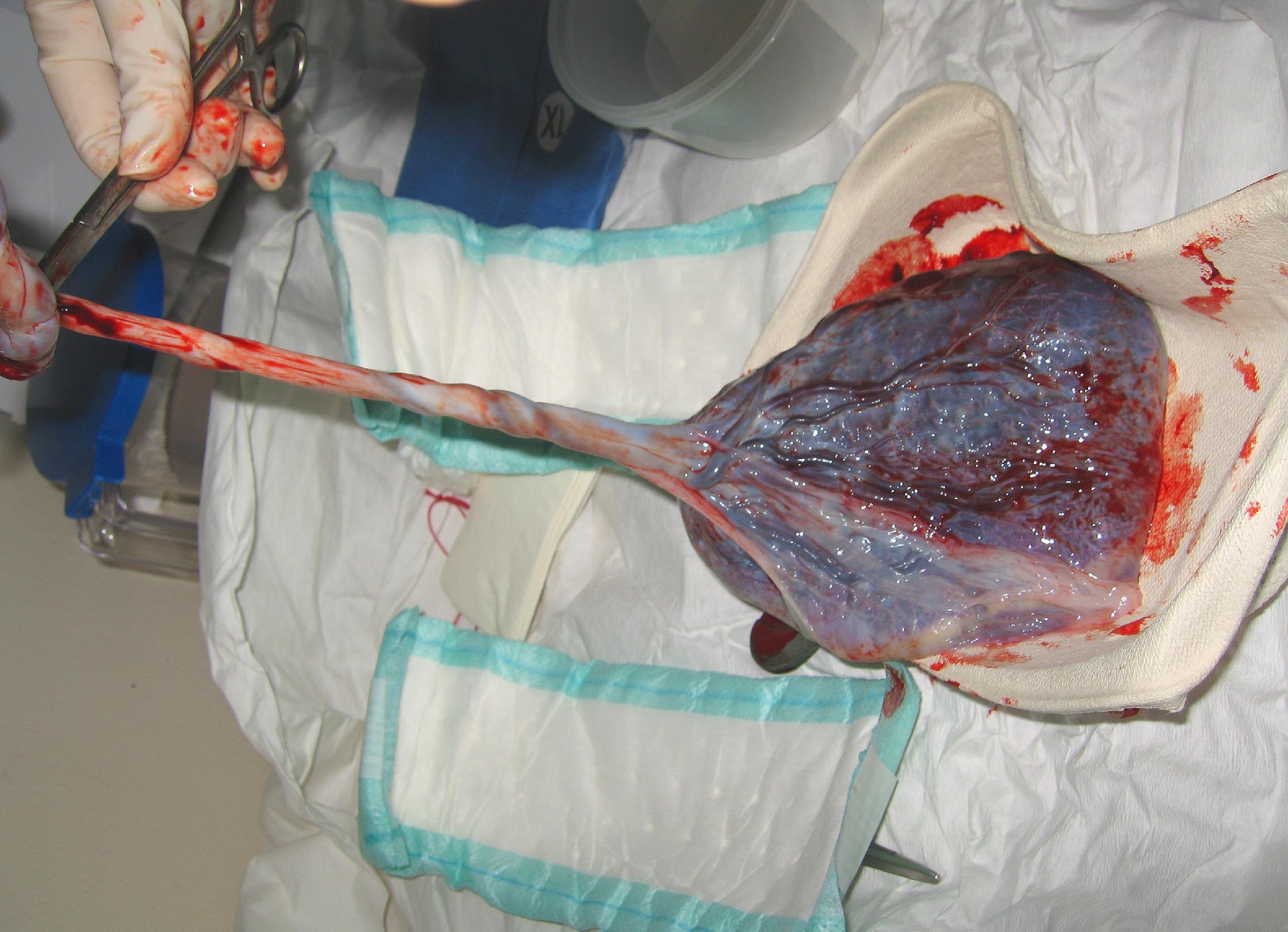 Image of placenta.jpg