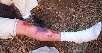 Image of injuredleg.jpg