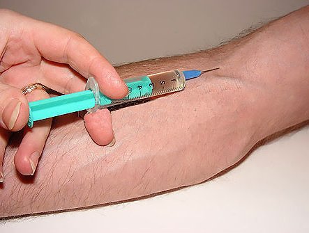 Image of ivinjectionintoarm.jpg