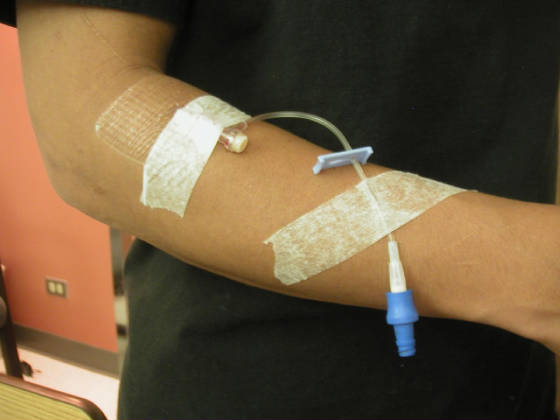Image of ivsitearmcloseup.jpg
