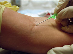 Image of ivstartingarm.jpg