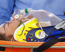 Image of spinal1.jpg