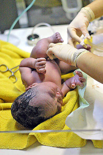 Image of umbilical-newborn.jpg
