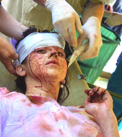 Image of victimgirljheadinjured.jpg