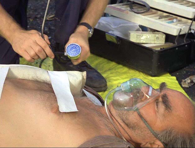 Image of victimpulsebpoxygen.jpg