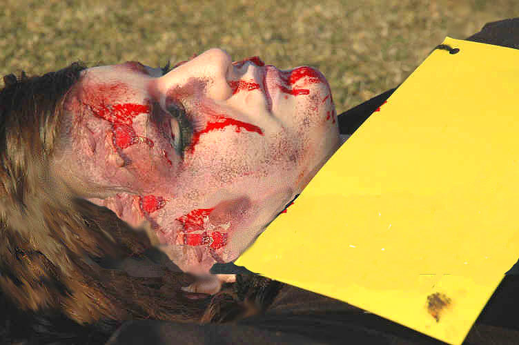 Image of victimwoundedlady.jpg