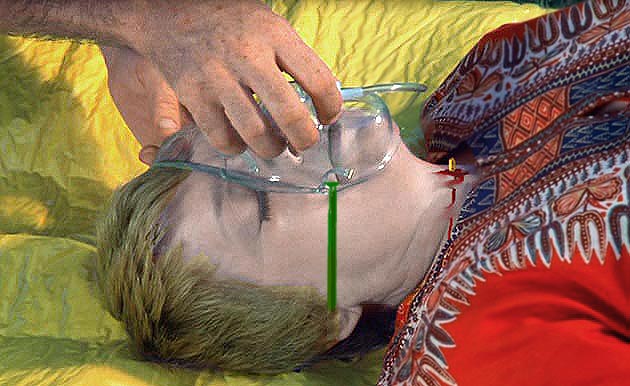 Image of womanoxygenclose.jpg